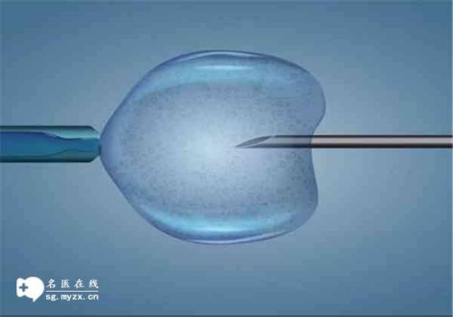 免疫性不孕的原因有哪些？免疫性不孕需要多调理